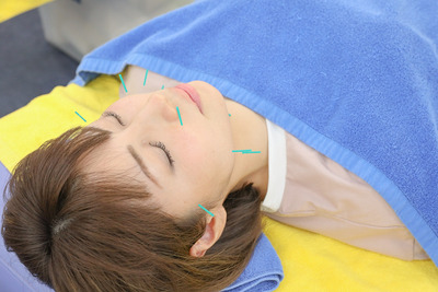 美容鍼灸アイコン